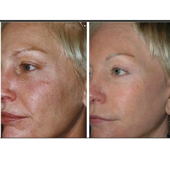 Luna Retinol sleeping night oil.0.5 oz new in box - Picture 12 of 12